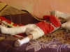 Xenia in het gips